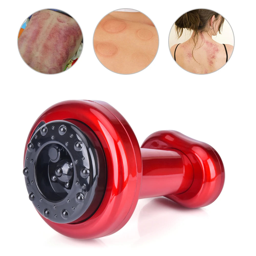 Vacuum Cupping Body Massager Detoxifier Fat Burner